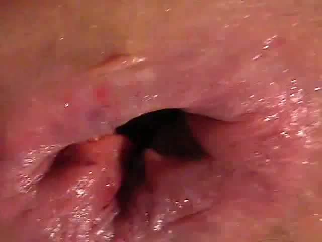 Disease From Anal Sex - Anal fucking during pooping - scat porn at ThisVid tube