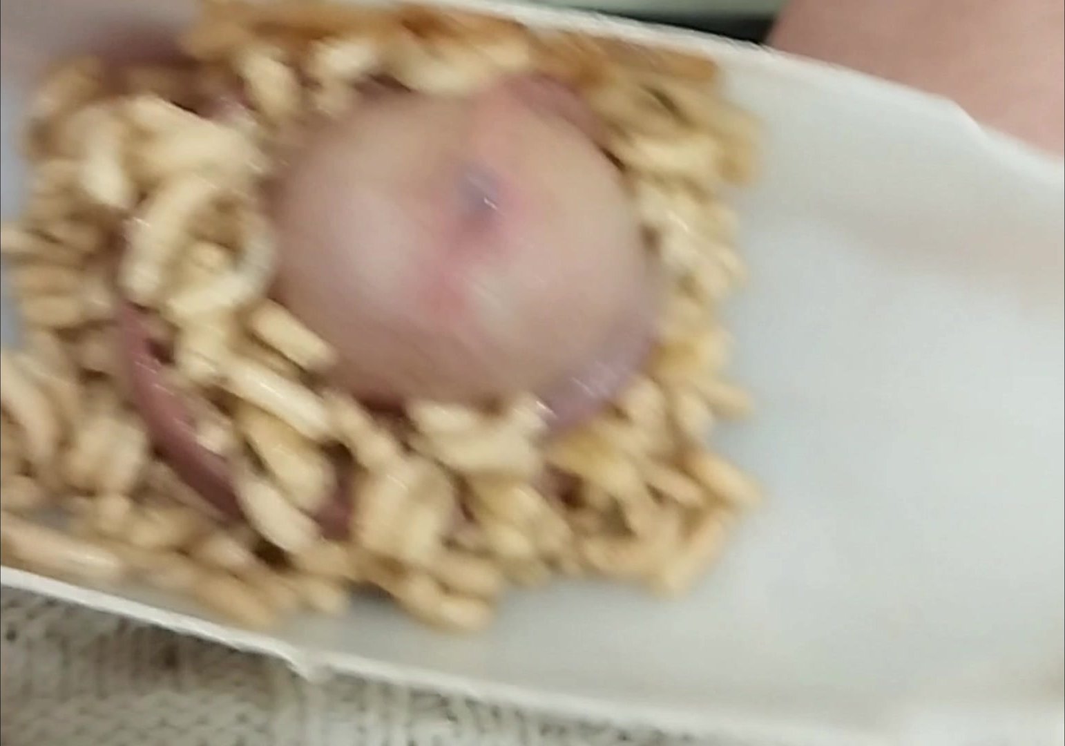 Maggots in foreskin 2/2 for GAELLE DERIVAL - ThisVid.com