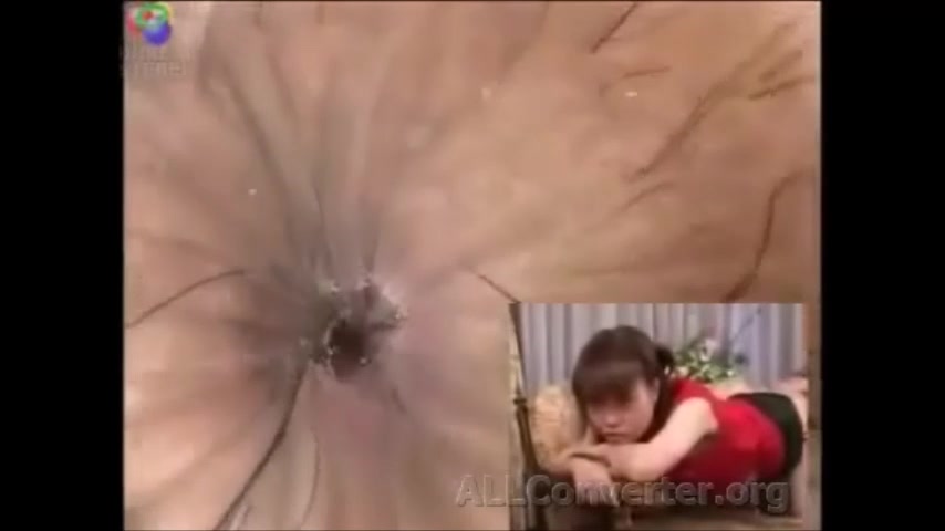 Camera inside rectum - ThisVid.com