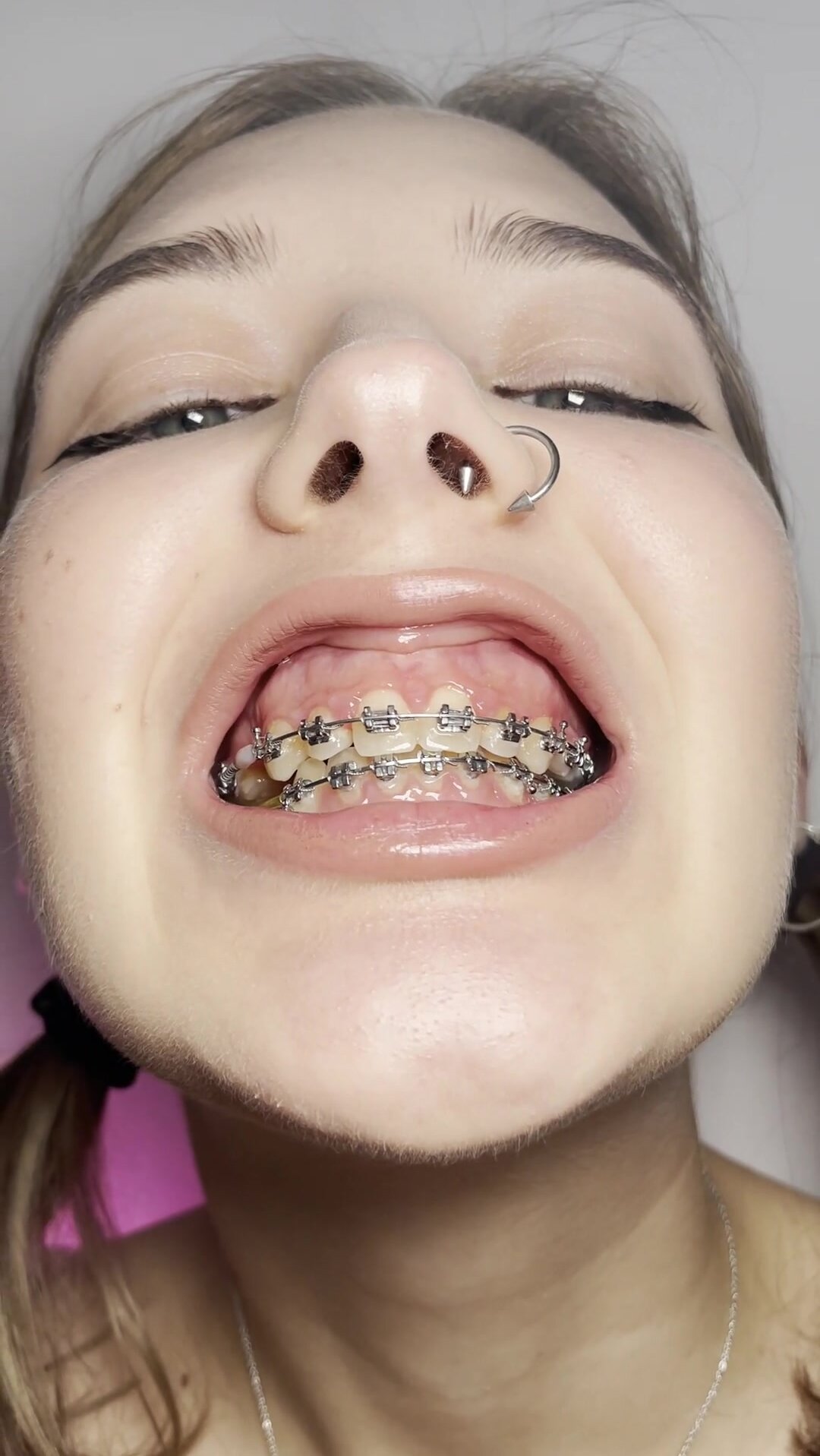 Braces fetish - ThisVid.com