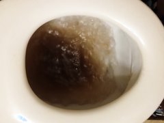 Diarrhea in the toilet