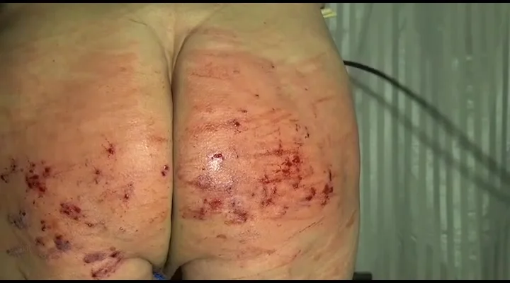 720px x 400px - Self bloody ass whipping - ThisVid.com