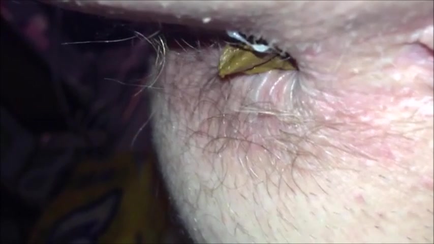 854px x 480px - Hairy woman shitting close up - ThisVid.com