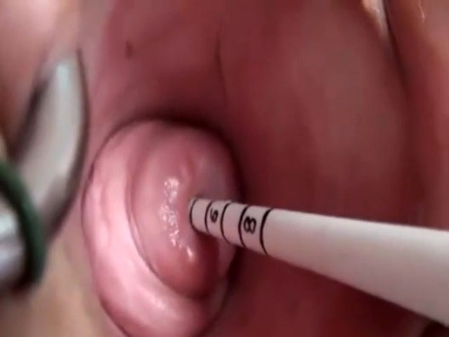 Woman fucks her cervix