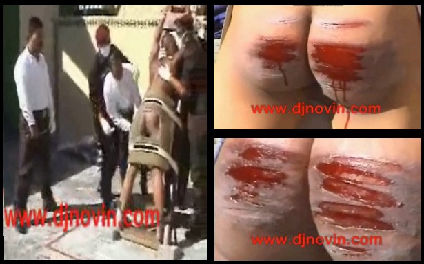 Bloody Caning - Malaysian Judicial Caning - Full - ThisVid.com