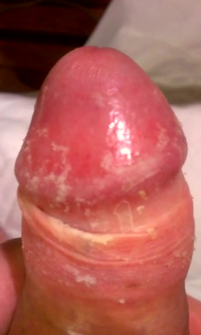 uncut cheese cock 2
