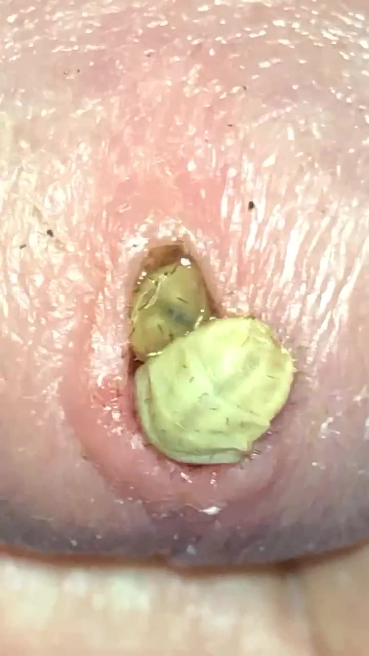 Maggots inside cock