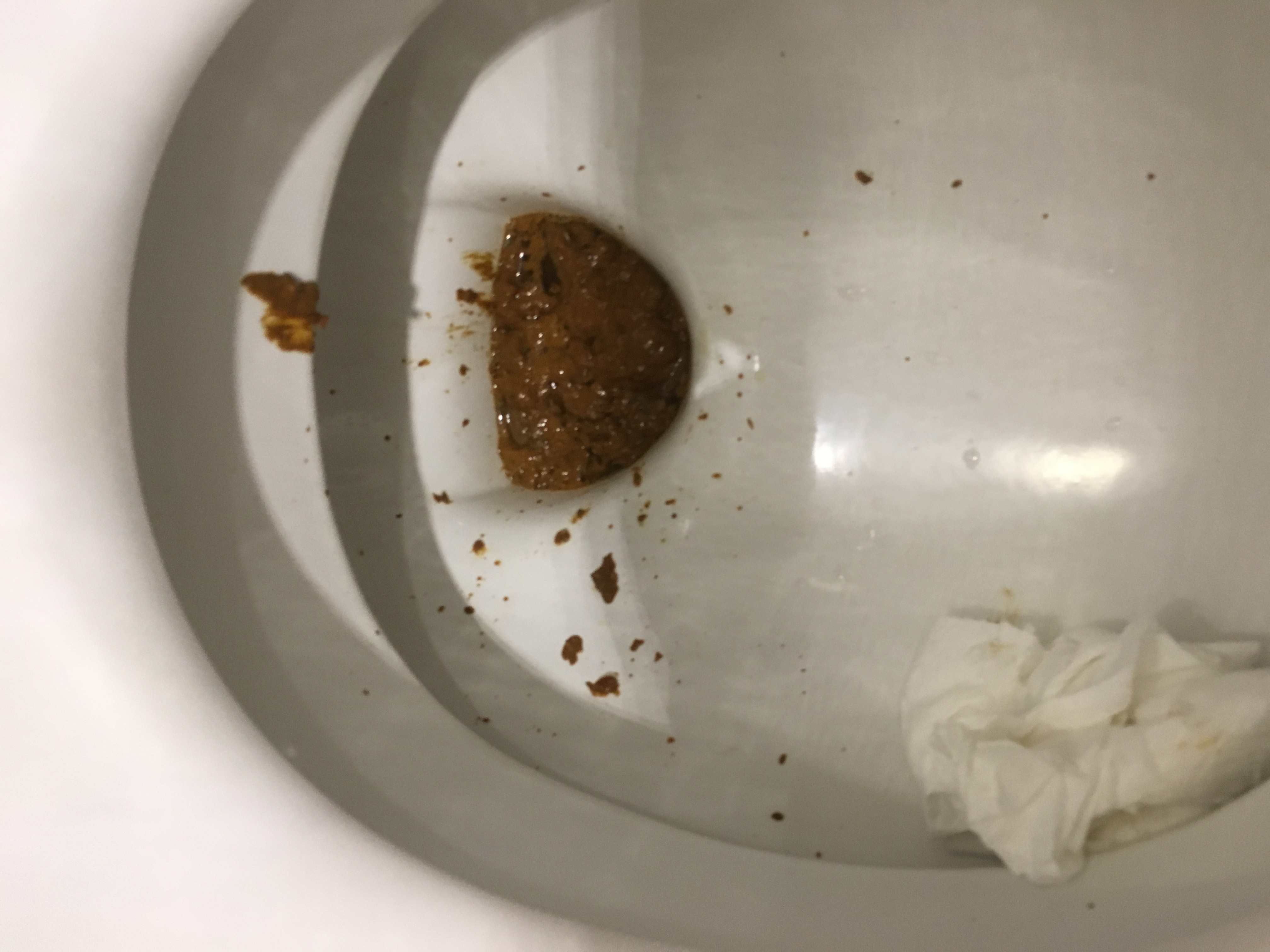 explosive diarrhea at work 09/19/2017