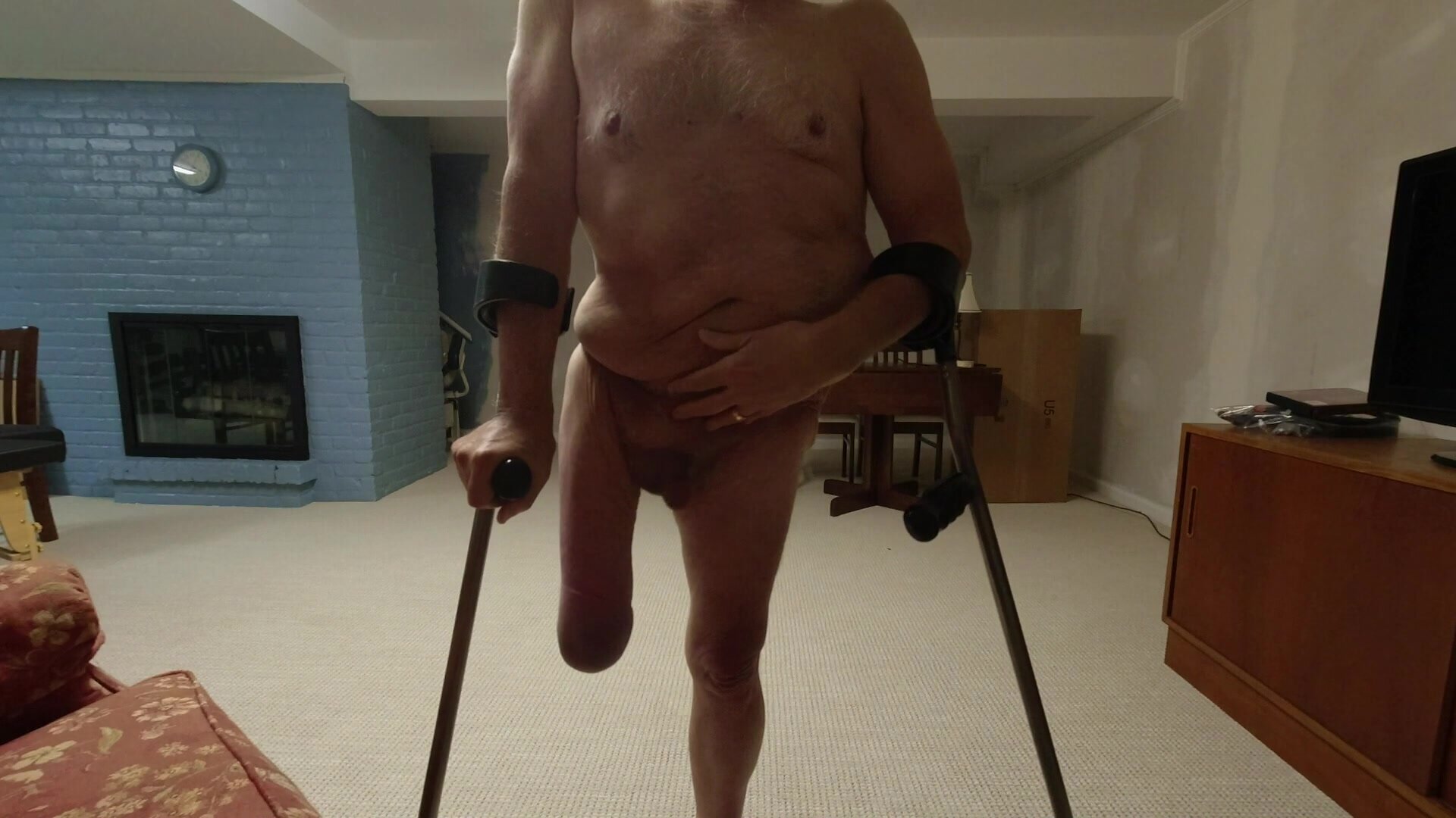 Deformed Body Porn - Polio Amputee Cripple Shows Off Deformed Body - ThisVid.com