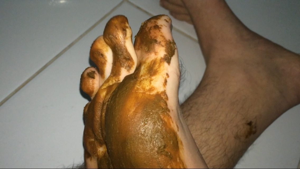 Shitty feet