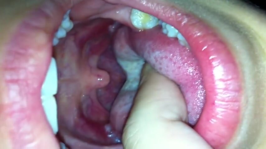Throat Lump Porn - Russian girl mouth - video 2 - ThisVid.com