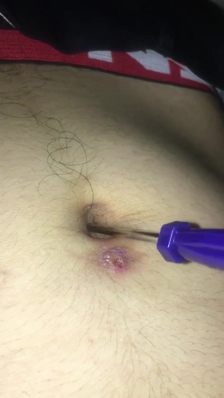 Navel torture with a screwdriver