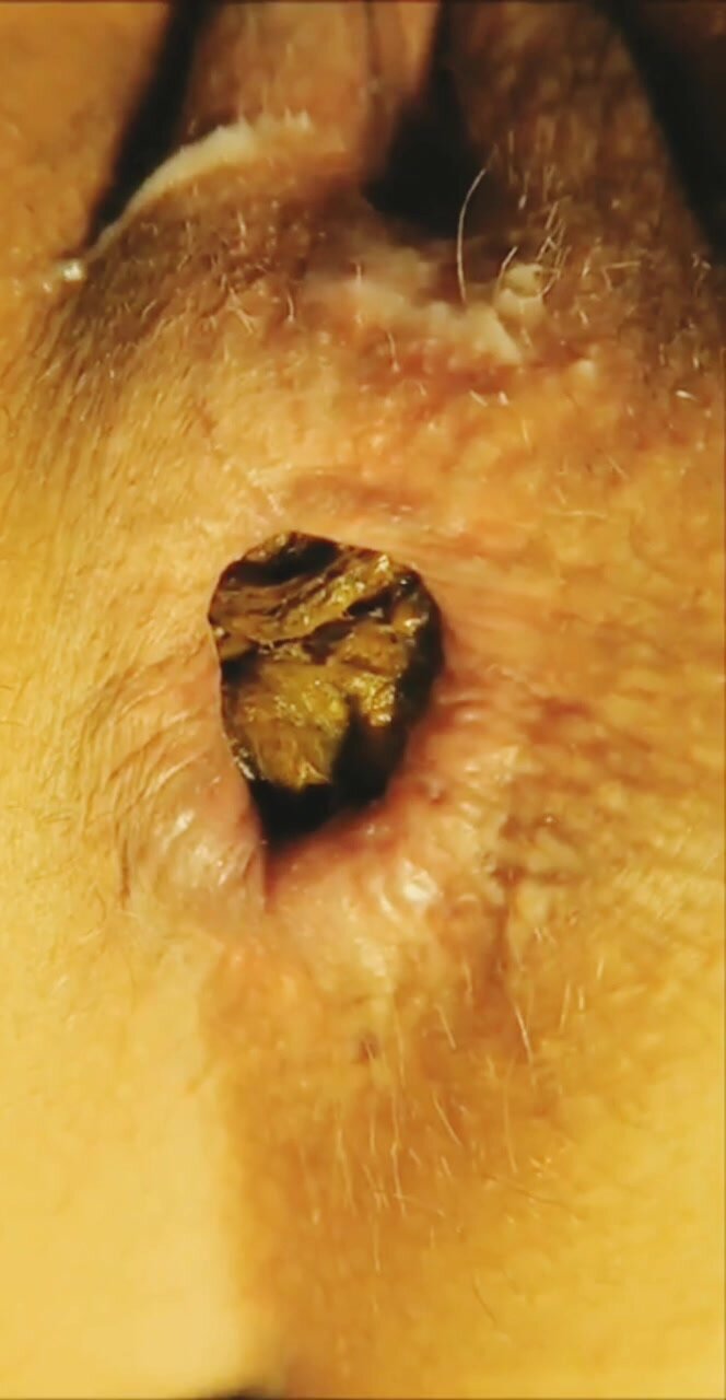 Closeup Milf Shit - ThisVid.com
