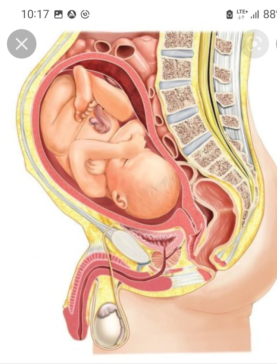 Pregnant Anatomy Porn - Pregnant guy just before birth - ThisVid.com
