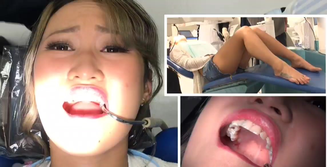 1144px x 586px - Japanese girl has drilling done at dentist part 1 - ThisVid.com