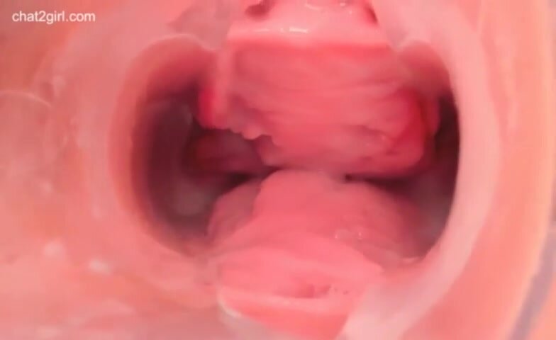      cervix speculum gaping 