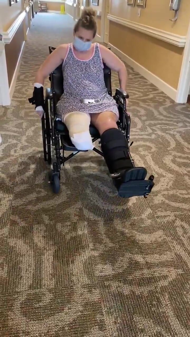 Sbk amputee in wheelchair with vast boot photo image