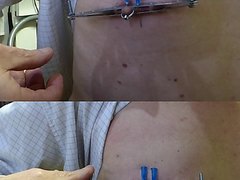 2 needles in tit tribute mistress JEZZ