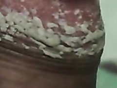 Uncut Cheesy Black Cock