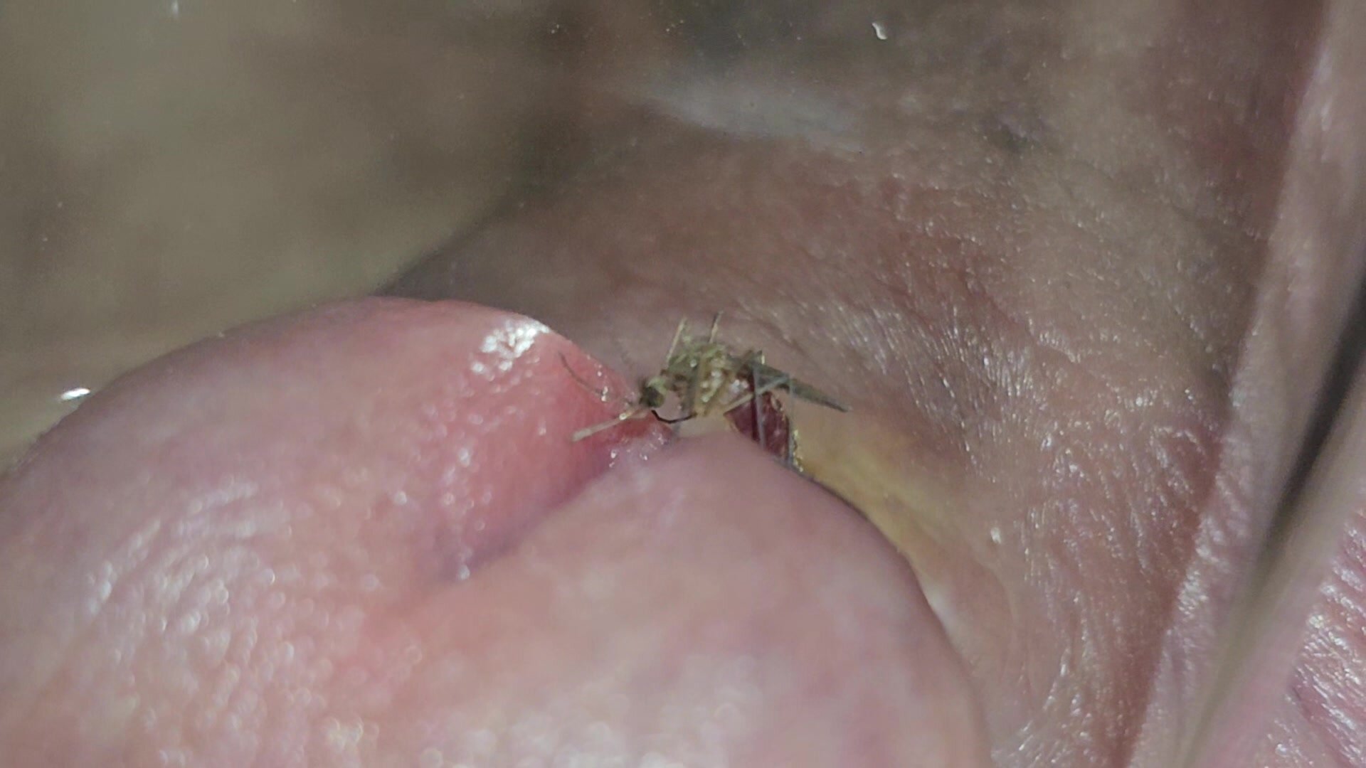 small amateur mosquito 1 Porn Photos