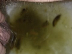 Farty Drippy Diarrhea