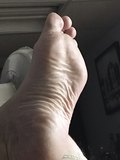 Big feet
