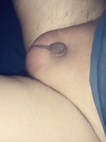 Micro pênis