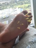 Needles in soles feet foot 2