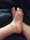chub feet
