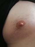 Removing nipples