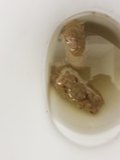 Found in public toilet