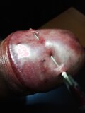 Painful needles cbt