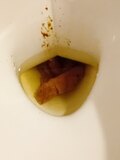 My poop