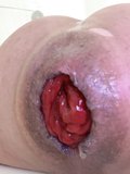Prolapse. Pump pussy and anal. Prolapse pussy and anal