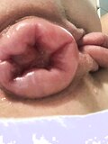 Prolapse. Pump pussy and anal. Prolapse pussy and anal