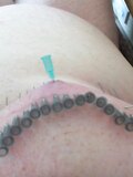 needle n tits