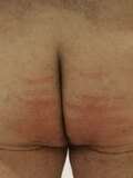 After a caning