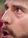 CM Punk's Nose