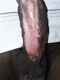 Fully subincision cock