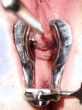 Cervix and urethra sounding
