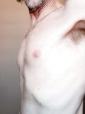 chest nipples