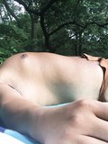sunbathing, Central Park, bikini, thong, speedo, underwear, swimsuit 2 - album 3