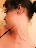 Variety of female neck veins
