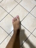 All types of feet