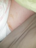 Real incontinent girl wears diaper in bed