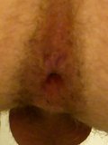 Another Huge Turd Stretches Anus While Balls Dangle