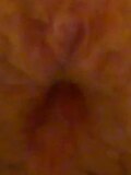 Another Huge Turd Strecthes Anus While Balls Dangle, CLOSEUP