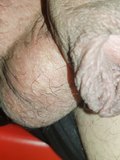 foreskin and softie