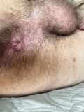 My used and gaping hole