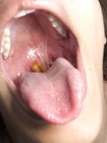 Nice view of hungry mouth